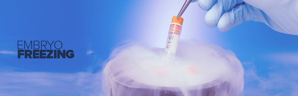 Embryo Freezing